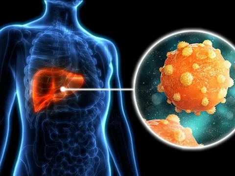 Viêm gan C lây như thế nào?